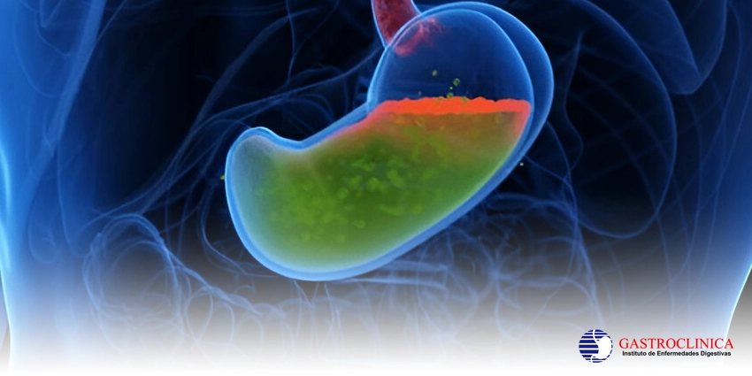 Publicacion: El reflujo gastroesofágico