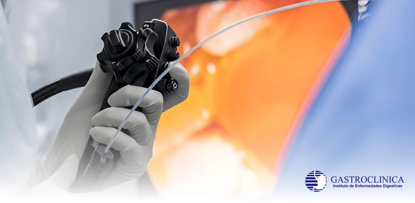 Servicio Endoscopía del Tubo Digestivo Superior