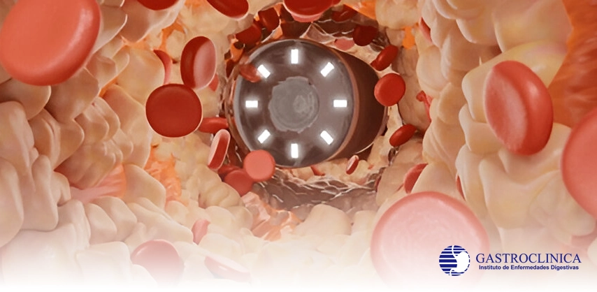 Servicio GASTROCLINICA Cápsula Endoscópica