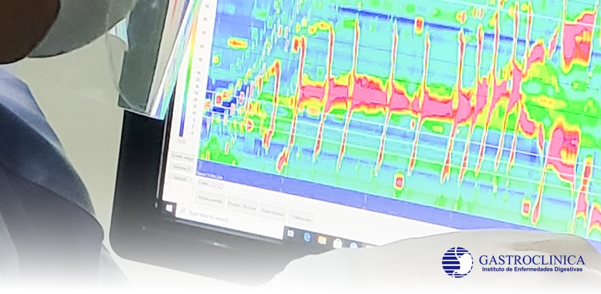 Servicio GASTROCLINICA Manometría Esofágica de Alta Resolución